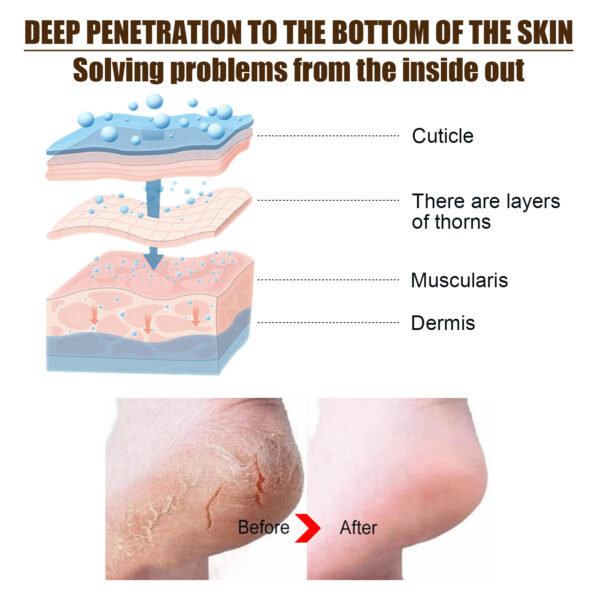 Hand and Foot Moisturizer - Softens Skin, Reduces Signs of Aging, Moisturizing Formula for the Whole Body GIft Skincare Hydrating Moisture