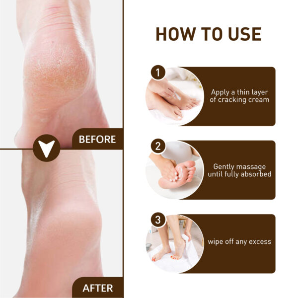 Hand and Foot Moisturizer - Softens Skin, Reduces Signs of Aging, Moisturizing Formula for the Whole Body GIft Skincare Hydrating Moisture